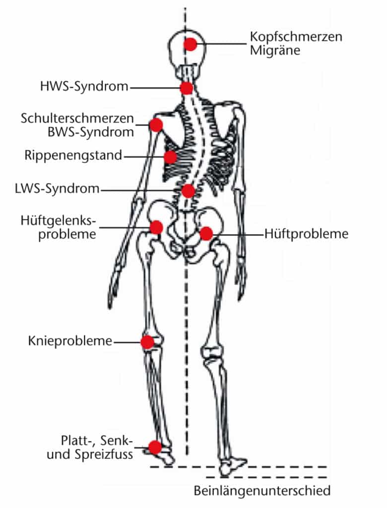 Die häufigsten Beschwerden, die durch falsche Schuhe verursacht werden